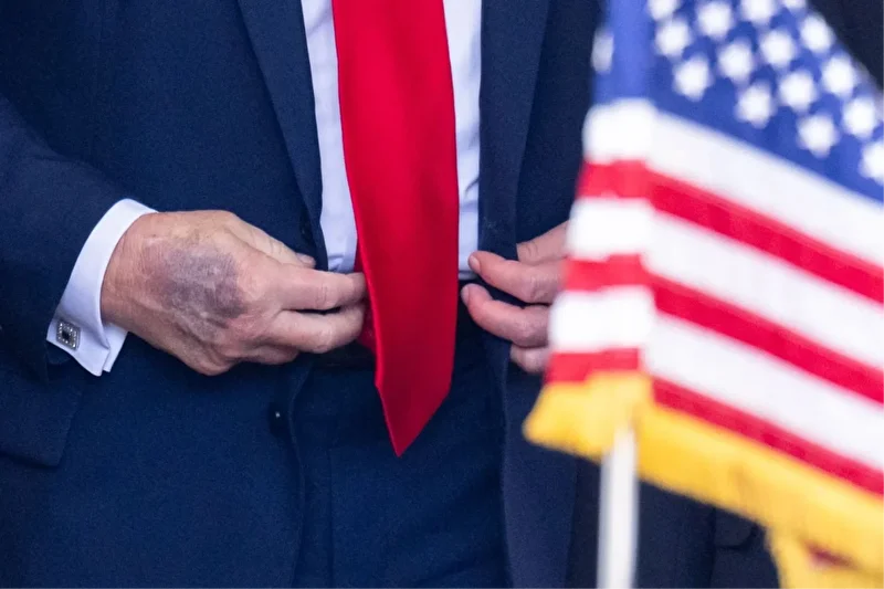Trump 5 gündür kayıp: Bedenindeki değişiklikler dikkat çekmişti 2 trump 5 gundur kayip bedenindeki degisiklikler dikkat cekmisti 1 utsB8DcL