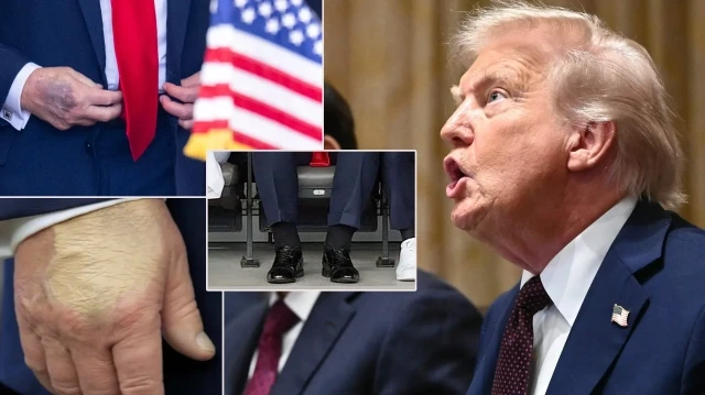 Trump 5 gündür kayıp: Bedenindeki değişiklikler dikkat çekmişti trump 5 gundur kayip bedenindeki degisiklikler dikkat cekmisti WLxWE2Ps.webp