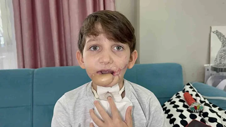 10 yaşındaki çocuk tüfekle çenesinden vuruldu 3 10 yasindaki cocuk tufekle cenesinden vuruldu 2 gD7FmaWs