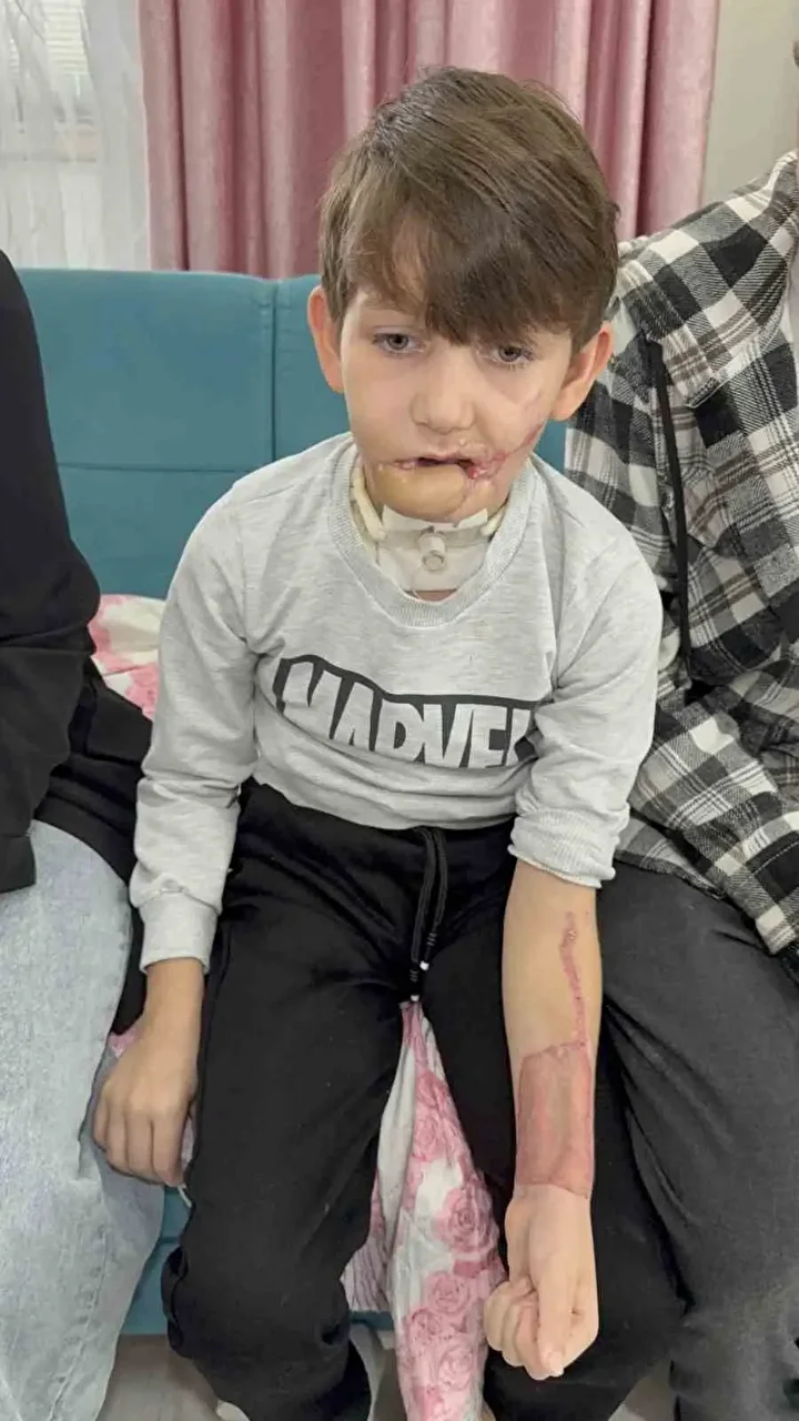 10 yaşındaki çocuk tüfekle çenesinden vuruldu 5 10 yasindaki cocuk tufekle cenesinden vuruldu 4 jc8uG1Lc