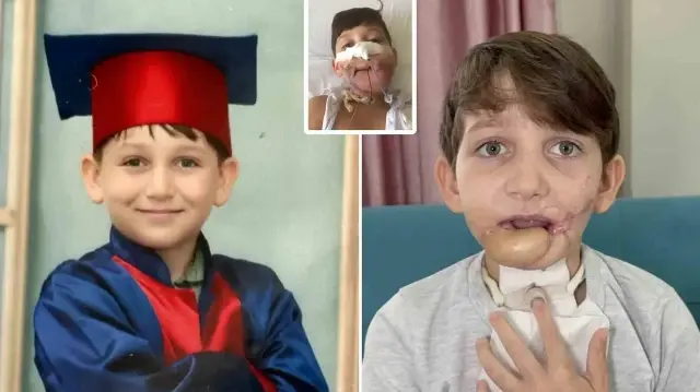 10 yaşındaki çocuk tüfekle çenesinden vuruldu 10 yasindaki cocuk tufekle cenesinden vuruldu mZO3yP8U.webp