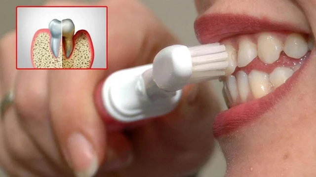 agiz bakterileri kalp krizine yol acabilir BXnS8BgV.webp