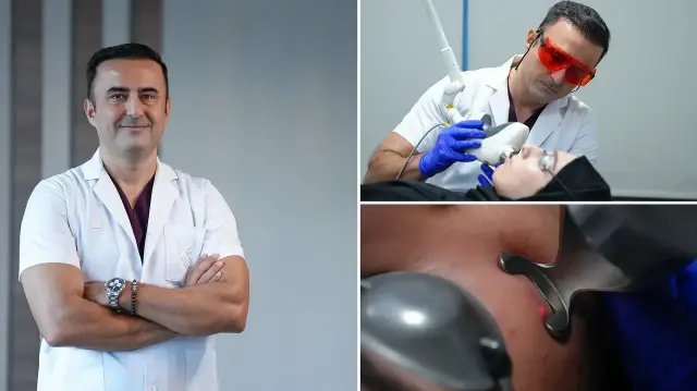 Akne tedavisinde esirgeyici hekimlik değer taşıyor: Yeni jenerasyon tekniklerle tesirli sonuçlar akne tedavisinde esirgeyici hekimlik deger tasiyor yeni jenerasyon tekniklerle tesirli sonuclar h6axqddy.webp