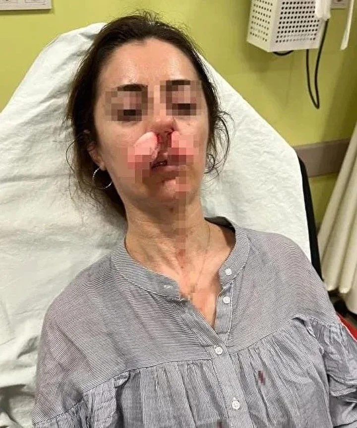 arabanin kapisi silah sayildi esinin kiz arkadasi sandi otomobilin kapisiyla saldirdi 1 4QMSQykb