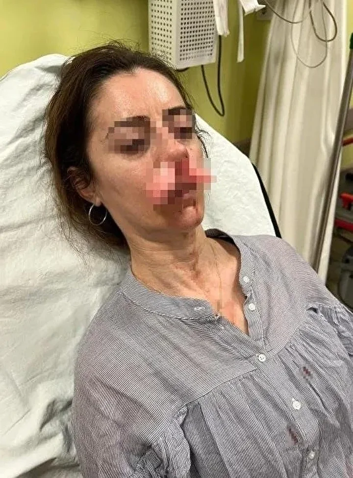 arabanin kapisi silah sayildi esinin kiz arkadasi sandi otomobilin kapisiyla saldirdi 3 DKmUsQB4