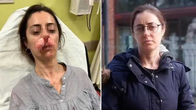 arabanin kapisi silah sayildi esinin kiz arkadasi sandi otomobilin kapisiyla saldirdi UJVbxfXA.webp