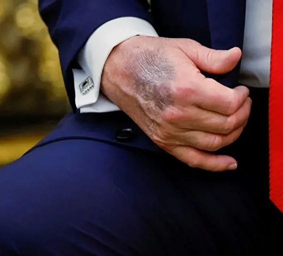 donald trump oldu tezleri sonrasi aciklama gunlerdir ortada yoktu birinci kere kamuoyu karsina cikiyor gqcjQ8yl