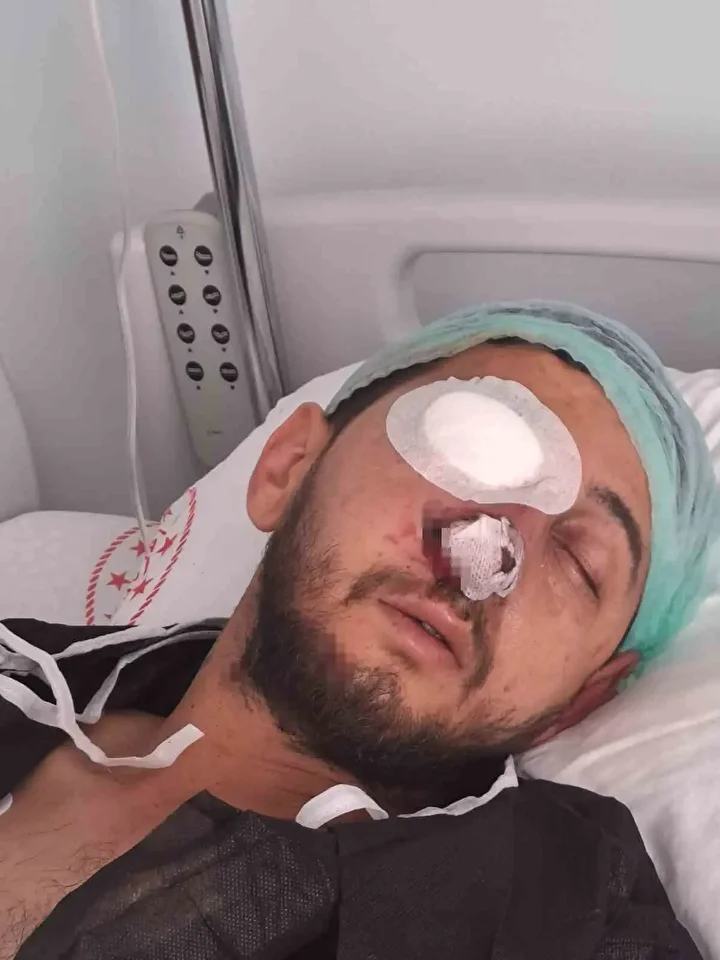 dugun cumbusu kabusa dondu havai fisek patlayinca gozunden oldu 3 1FikeVMz