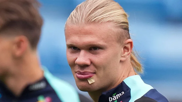 erling haalanddan korkutan sakatlik yuzu taninmaz hale geldi 0 kqIZWIiI