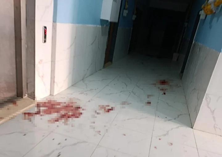 Eşinin bıçakladığı Ceylan ağır yaralandı 1 esinin bicakladigi ceylan agir yaralandi 0 RgQhbQLz
