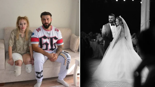 Evlilik yıl dönümünde kâbusu yaşadı: İki bacağını kaybetti… evlilik yil donumunde k busu yasadi iki bacagini kaybetti ARx319QA.webp