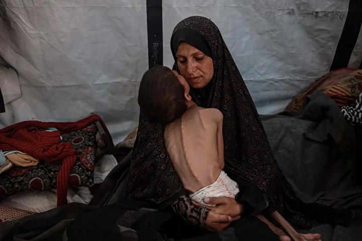 gazzede 10 yasindaki cocuk agir yetersiz beslenme ile karsi karsiya 19 LTANsJfa
