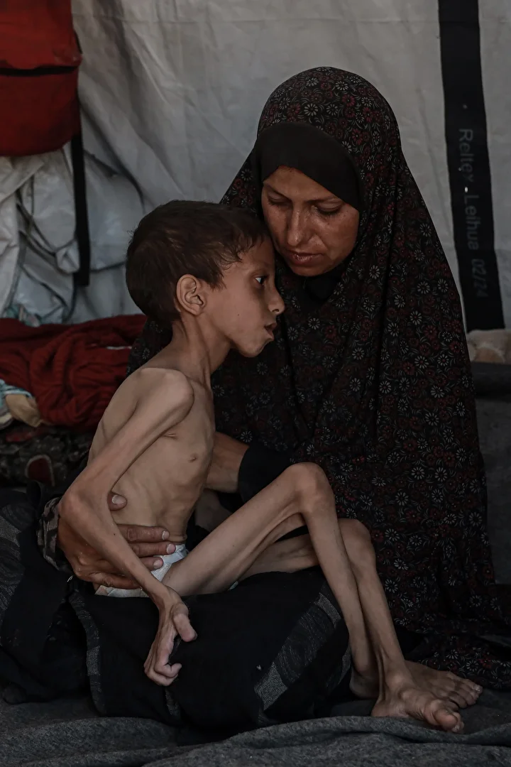 gazzede 10 yasindaki cocuk agir yetersiz beslenme ile karsi karsiya 23 KOvPSNYn
