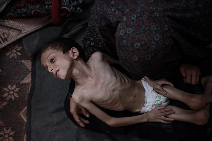 gazzede 10 yasindaki cocuk agir yetersiz beslenme ile karsi karsiya 27 ju5kFhak