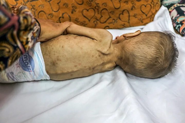 gazzede bebekler aclikla ugras ediyor 12 vuiWSHzj