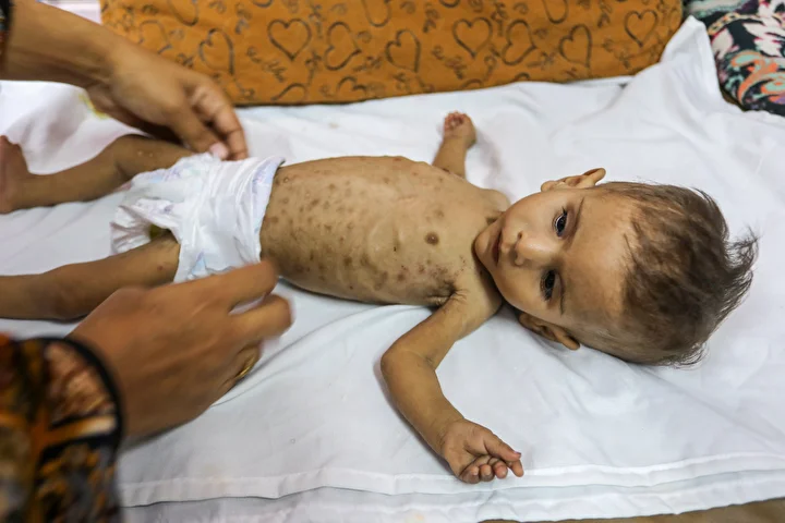 gazzede bebekler aclikla ugras ediyor 13 wekFYEZR