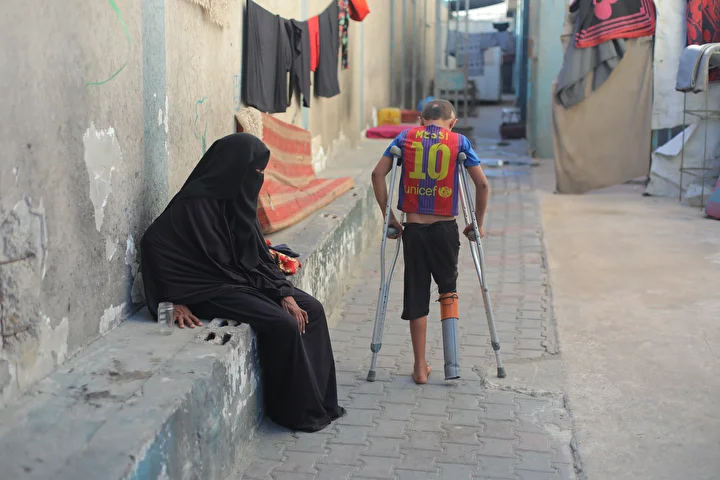 gazzede bir bacagini kaybeden 9 yasindaki ratibin protez umudu 20 PJTmNqUh