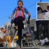 gazzede bir bacagini kaybeden 9 yasindaki ratibin protez umudu AmpYzCa8.webp