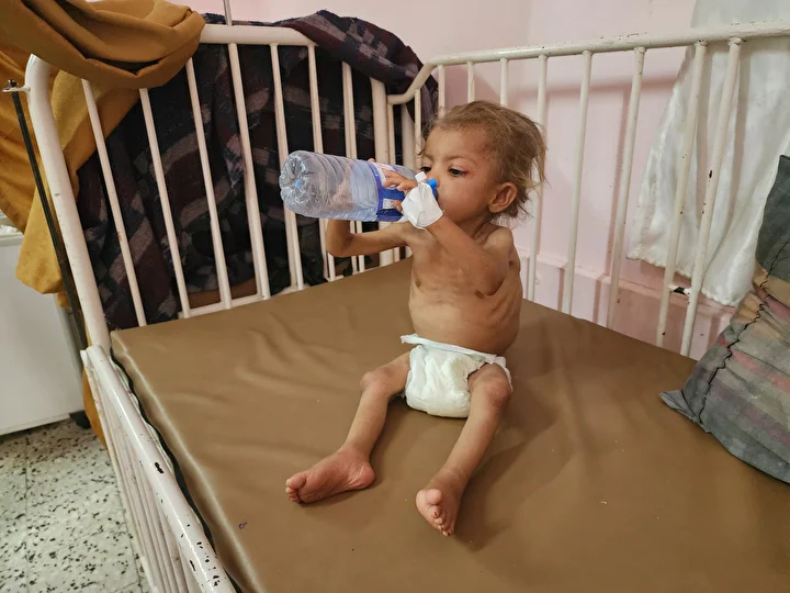 gazzede cocuklarda yetersiz beslenme olaylarinda artis yasaniyor 6 17MTifjN
