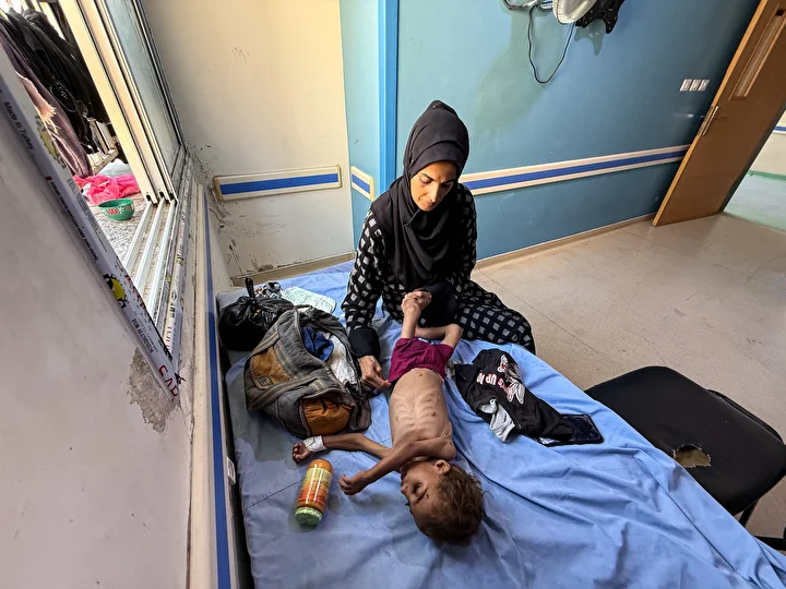 gazzede yetersiz beslenme hadiseleri en yuksek duzeylerine ulasti 13 FSa2qz5p