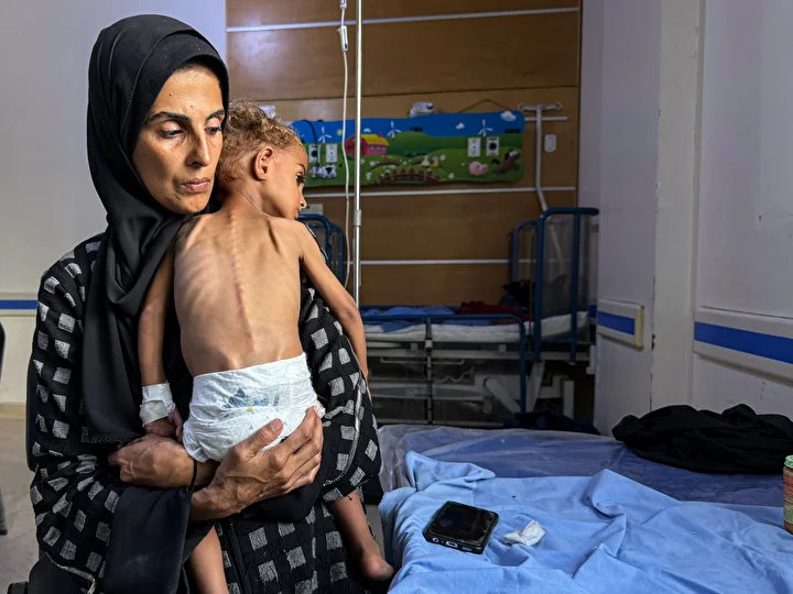 gazzede yetersiz beslenme hadiseleri en yuksek duzeylerine ulasti 20 IlItnyiE
