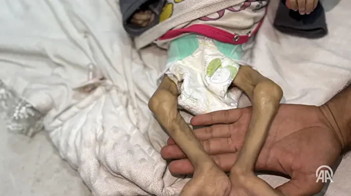 Gazze'deki vahşetin fotoğraflarını gösterirken duygulandı: İşte Cumhurbaşkanı Erdoğan'ın dünya önderlerine gösterdiği fotoğraflar 7 gazzedeki vahsetin fotograflarini gosterirken duygulandi iste cumhurbaskani erdoganin dunya onderlerine gosterdigi fotograflar 6 qkzre2BY