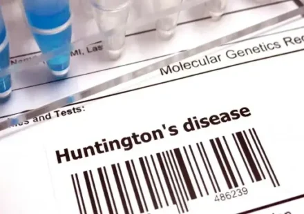 Huntington hastalığında tarihi gelişme: Yeni tedavi yüzde 75 yavaşlatıyor huntington hastaliginda tarihi gelisme yeni tedavi yuzde 75 yavaslatiyor 7BGvJ7Qy.webp