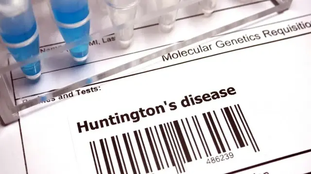 Huntington hastalığında tarihi gelişme: Yeni tedavi yüzde 75 yavaşlatıyor huntington hastaliginda tarihi gelisme yeni tedavi yuzde 75 yavaslatiyor 7BGvJ7Qy.webp