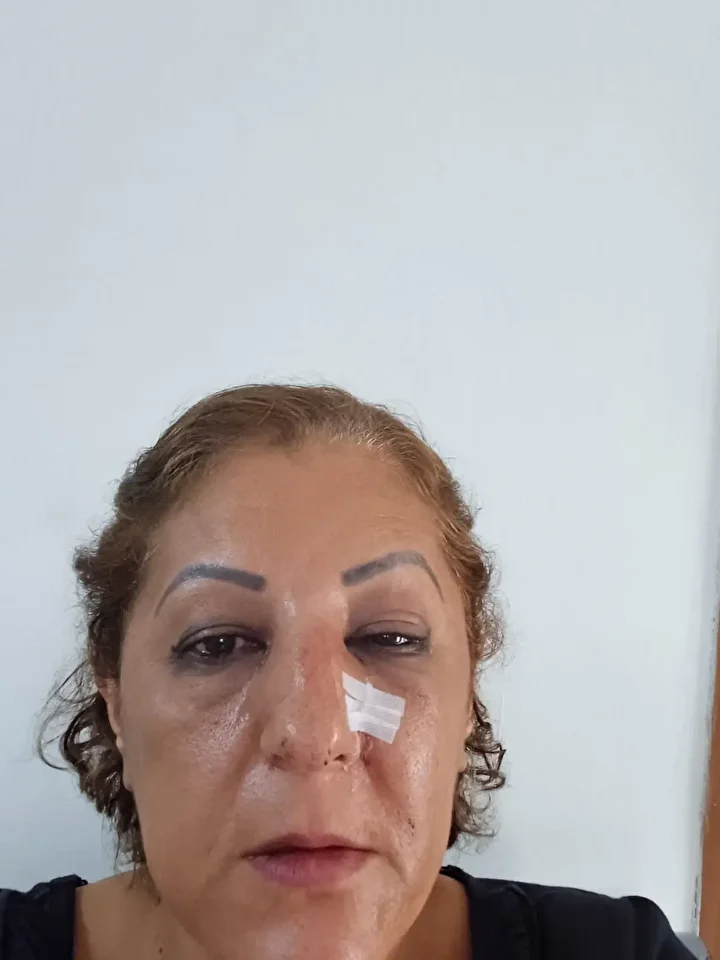 Komşuların kedi besleme hengamesi: Apartmanda tekme yumruk hücum 4 komsularin kedi besleme hengamesi apartmanda tekme yumruk hucum 3 j4rHkYmP