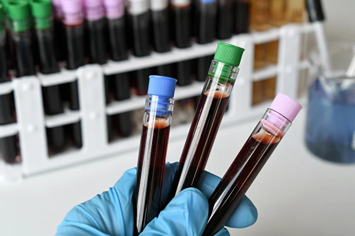 m cicegi alarmi tum vilayetleri sardi olumcul virus suratle yayiliyor 5 Gv1KTsmF
