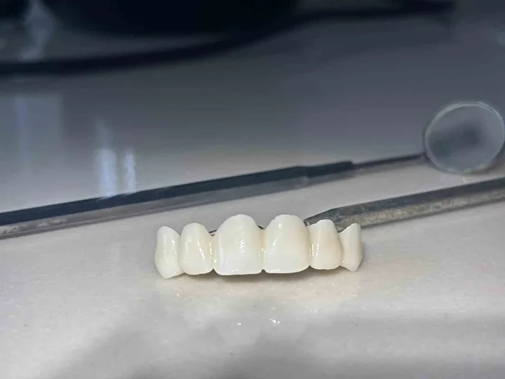 Özel kliniklerde 8 bin TL: Devlet hastanelerinde 188 TL’ye yapılmaya başlandı! Bakanlık onayı ile birinci sefer Sivas’ta yapıldı 1 ozel kliniklerde 8 bin tl devlet hastanelerinde 188 tlye yapilmaya baslandi bakanlik onayi ile fUerCnwR