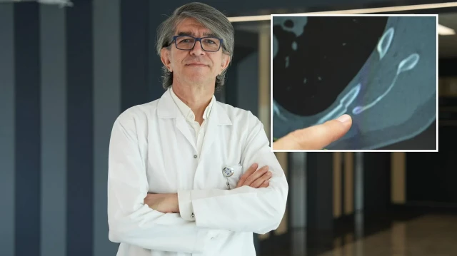 uzman isim uyardi oksururken kaburgalariniz kirilabilir ZwFRdK3S.webp