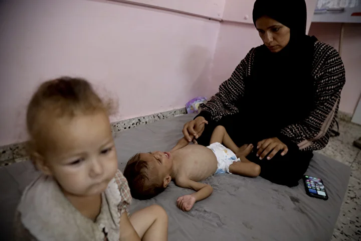yetersiz beslenme kaynakli can kayiplarinin artiyor gazzede hastanelerdeki cocuklar adeta mevti bekliyor 0 zXOwwF7F