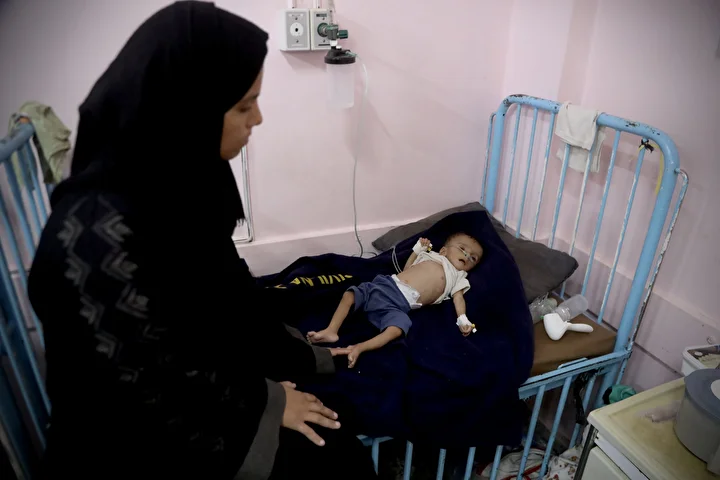 yetersiz beslenme kaynakli can kayiplarinin artiyor gazzede hastanelerdeki cocuklar adeta mevti bekliyor 16 IkcRq9mL