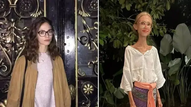 22 kiloya kadar düştü: Genç fenomenin uyguladığı diyet vefat getirdi 22 kiloya kadar dustu genc fenomenin uyguladigi diyet vefat getirdi W6DcSGCs.webp