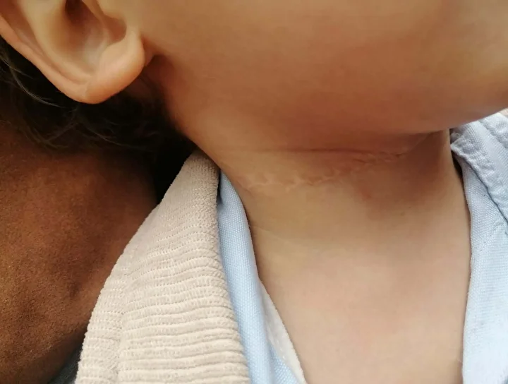 eskisehirde vahset 15 yasindaki cocugu boynundan yaraladi konutunu yakmaya kalkti 3 R7Ynf7h9