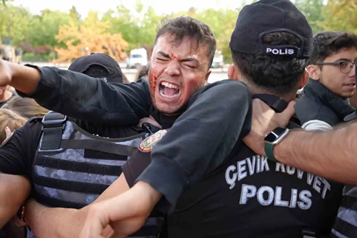 Gaziantep'te terör tatbikatında kendini rolüne kaptıranlar zahmetle sakinleştirildi 2 gaziantepte teror tatbikatinda kendini rolune kaptiranlar zahmetle sakinlestirildi 1 NsGGj59a
