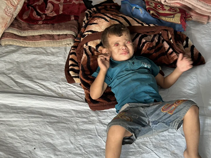 İsrail'in kıtlığa sürüklediği Gazze'de 'Göz kapağı' hastası 10 yaşındaki Ramez'in durumu yürek burkuyor 13 israilin kitliga surukledigi gazzede goz kapagi hastasi 10 yasindaki ramezin durumu yurek burkuyor 12 XA8X7WfR
