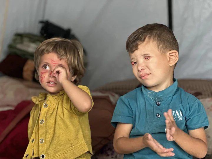 İsrail'in kıtlığa sürüklediği Gazze'de 'Göz kapağı' hastası 10 yaşındaki Ramez'in durumu yürek burkuyor 15 israilin kitliga surukledigi gazzede goz kapagi hastasi 10 yasindaki ramezin durumu yurek burkuyor 14 ujWaNvXJ