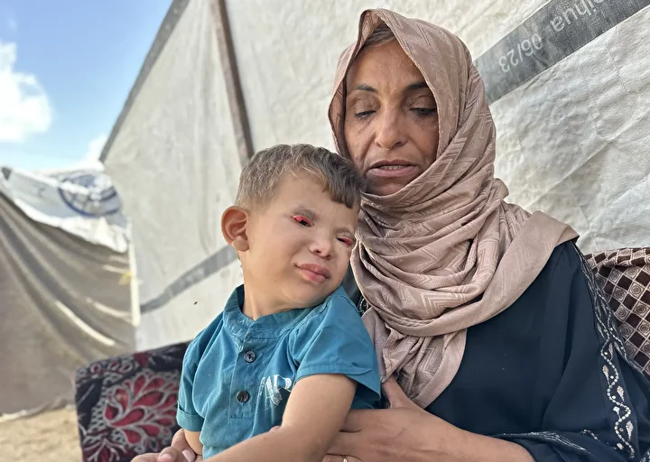 İsrail'in kıtlığa sürüklediği Gazze'de 'Göz kapağı' hastası 10 yaşındaki Ramez'in durumu yürek burkuyor 16 israilin kitliga surukledigi gazzede goz kapagi hastasi 10 yasindaki ramezin durumu yurek burkuyor 15 n2jvW6UJ