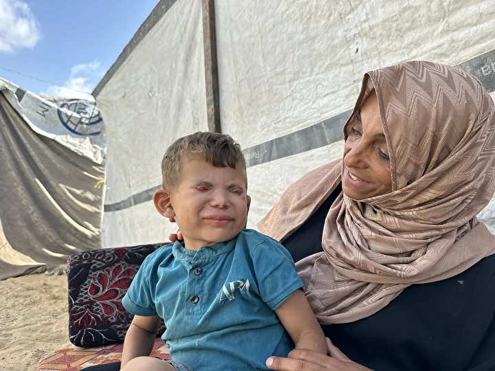 İsrail'in kıtlığa sürüklediği Gazze'de 'Göz kapağı' hastası 10 yaşındaki Ramez'in durumu yürek burkuyor 17 israilin kitliga surukledigi gazzede goz kapagi hastasi 10 yasindaki ramezin durumu yurek burkuyor 16 YpPdiLc2