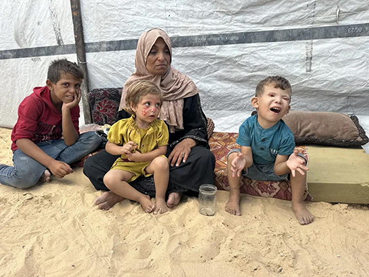 İsrail'in kıtlığa sürüklediği Gazze'de 'Göz kapağı' hastası 10 yaşındaki Ramez'in durumu yürek burkuyor 4 israilin kitliga surukledigi gazzede goz kapagi hastasi 10 yasindaki ramezin durumu yurek burkuyor 3 4GI5fwVz