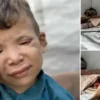 israilin kitliga surukledigi gazzede goz kapagi hastasi 10 yasindaki ramezin durumu yurek burkuyor DvqQ13Dl.webp