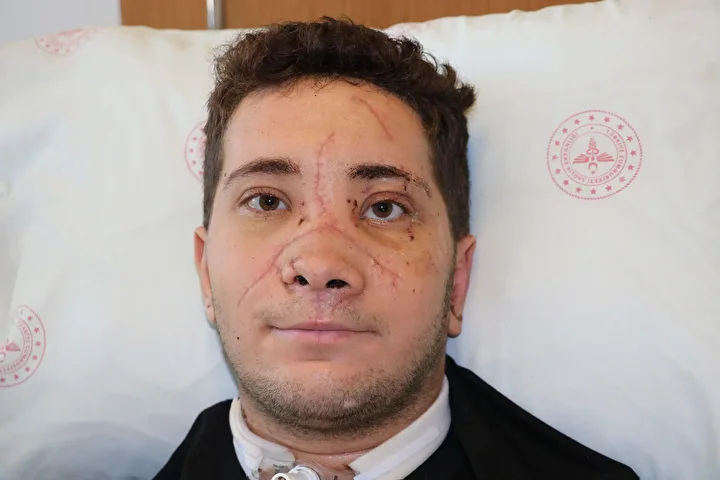 kazada burnu kopma noktasina geldi ameliyatla sihhatine kavustu guya hayata yine baslamis uzereyim 2 QWIvs8p9