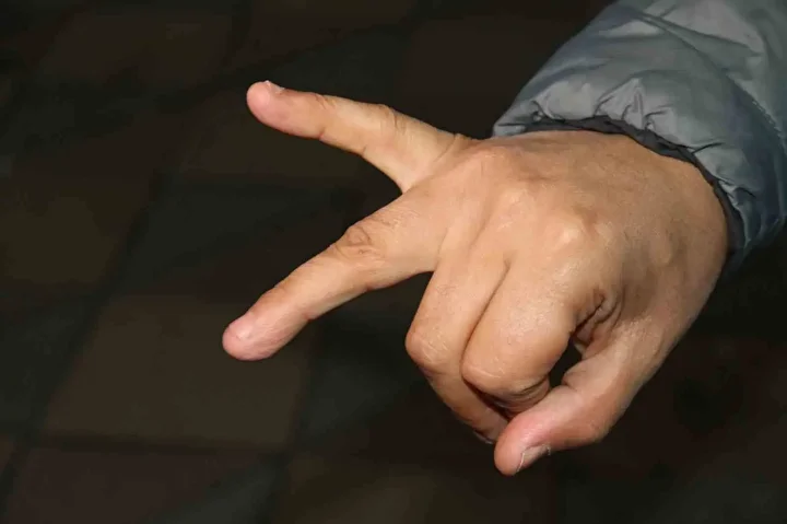 musteriyi balikla dovduler iade etmek istedi parmagindan oldu 2 ldGzDKb5