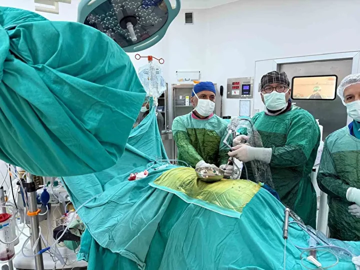 Organını büsbütün dolduran 8 santimetrelik 'geyik boynuzu' böbrek taşı ameliyatla çıkarıldı 2 organini busbutun dolduran 8 santimetrelik geyik boynuzu bobrek tasi ameliyatla cikarildi 1 rv8VYObS