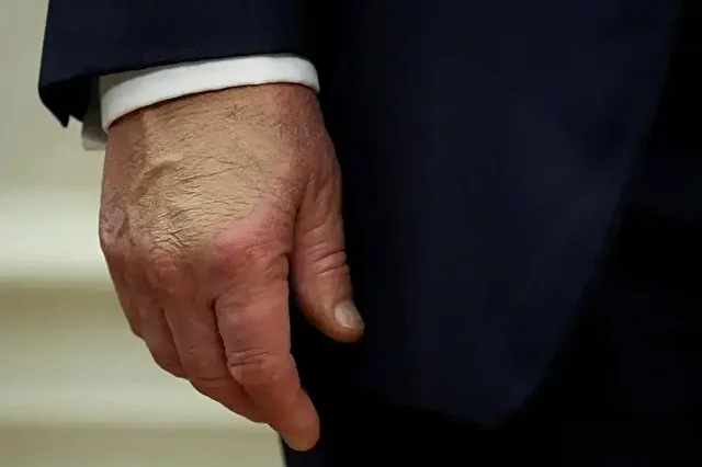 trumpin kalp yasi 65 cikti 0 hfMrCwd6