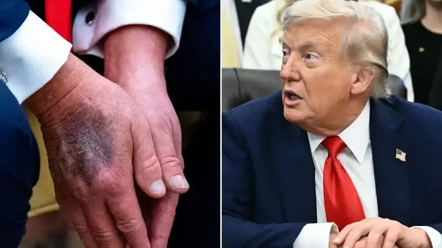 trumpin kalp yasi 65 cikti D3f7DNLh.webp