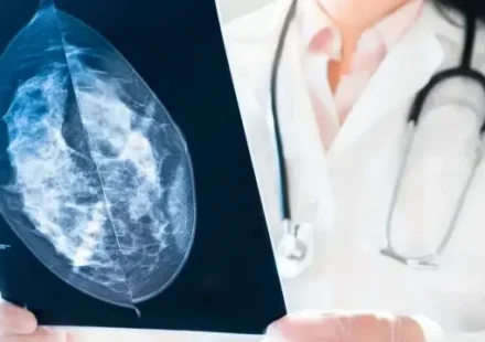 uzmanlar 40 yasindan sonra her bayana mamografi takibi oneriyor Q4zslzDM.webp