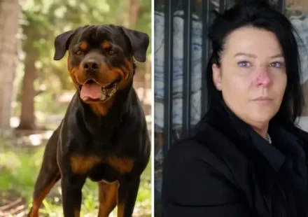 Arkadaşının köpeği tarafından burnu parçalanan bayan 8 ay pipetle beslendi: Acısı vahim bir acı ölmediğim için şükrediyorum arkadasinin kopegi tarafindan burnu parcalanan bayan 8 ay pipetle beslendi acisi vahim bir aci LwNPAW7n.webp